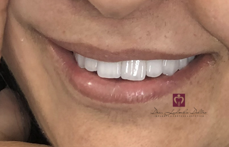 Foto 3 de Dentista Ludmila Daltro