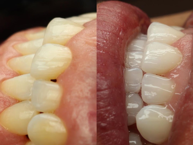 Foto 2 de Dentista macapa | Dra.Alynne Matos