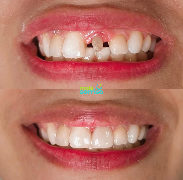 Foto 2 de Dentista Mais Sorriso