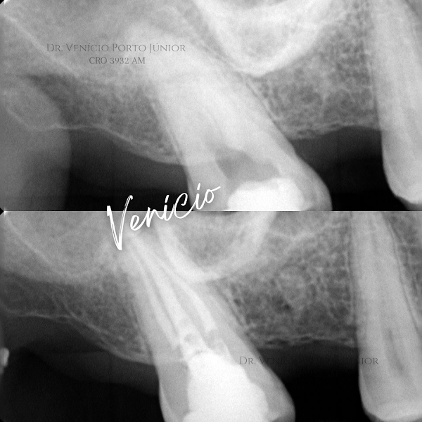 Foto 3 de Dentista (Manaus) Dr. Venício Porto Jr.