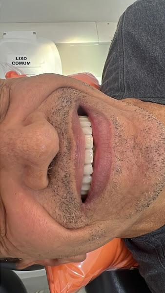 Foto 2 de Dentista Manaus - Dra Irla Thaís - Prótese Dentária