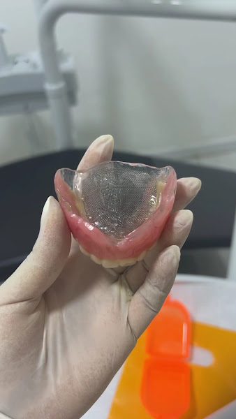 Foto 3 de Dentista Manaus - Dra Irla Thaís - Prótese Dentária