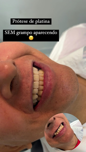 Foto 4 de Dentista Manaus - Dra Irla Thaís - Prótese Dentária