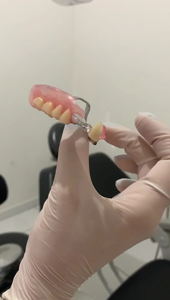 Foto 5 de Dentista Manaus - Dra Irla Thaís - Prótese Dentária