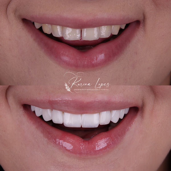 Foto 2 de Dentista Manaus - Dra. Karina Lopes