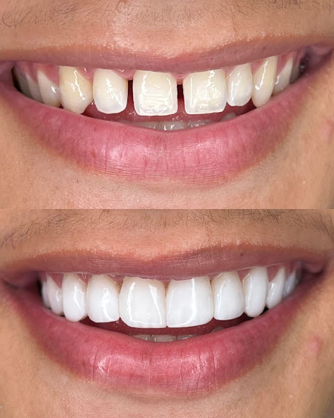 Foto 3 de Dentista Maracanaú DS Clinic - Clínica Odontologia e Estética