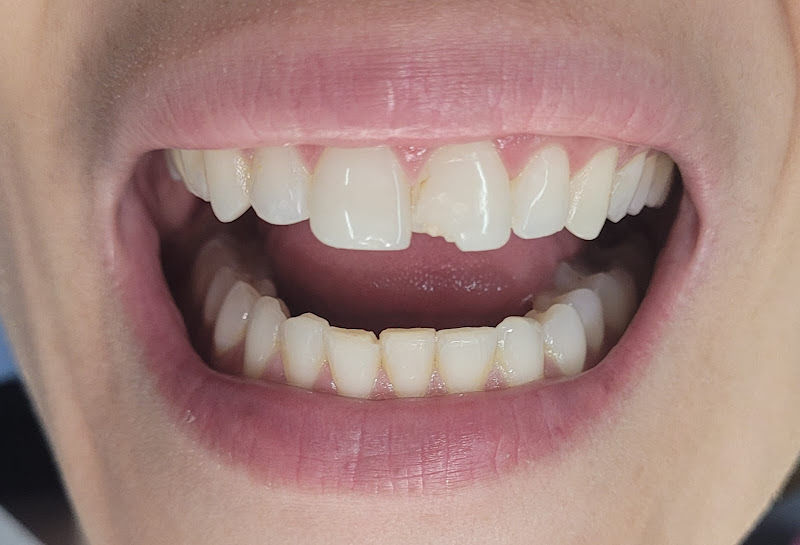 Foto de Dentista Maria Fernanda Naves | Odontologia | Alinhador Invisível - Uberlândia