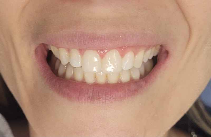 Foto 2 de Dentista Maria Fernanda Naves | Odontologia | Alinhador Invisível - Uberlândia