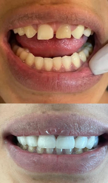 Foto 2 de Dentista Mogi das cruzes | Dra Mayra Alencar | Mogi das Cruzes