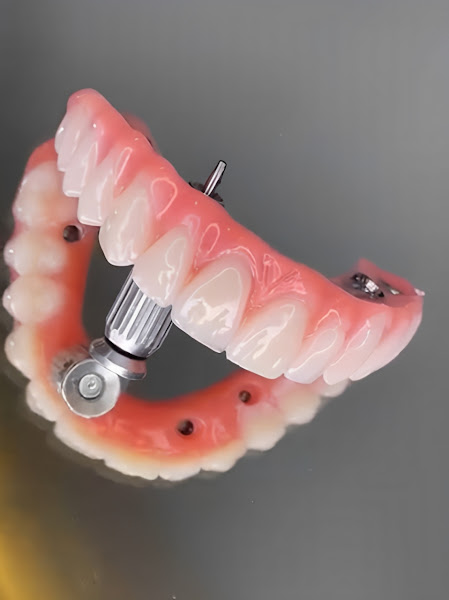 Foto 3 de Dentista Mogi das cruzes | Dra Mayra Alencar | Mogi das Cruzes