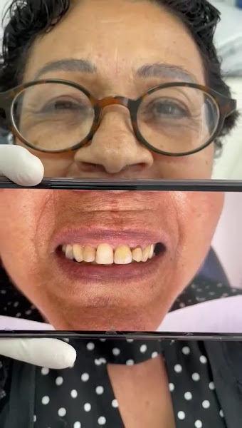 Foto 4 de Dentista Mogi das cruzes | Dra Mayra Alencar | Mogi das Cruzes