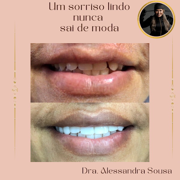 Foto 3 de Dentista, Montes Claros, Dra.Alessandra Sousa