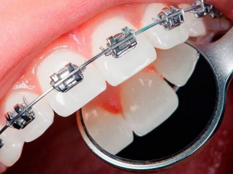 Foto 2 de Dentista na Vila Mariana - Clínica Mais Sorriso - 50m Shopping Metrô Santa Cruz