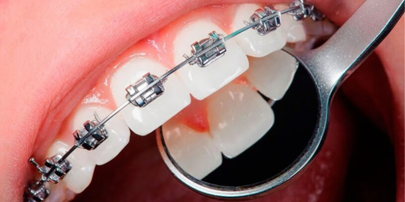 Foto 5 de Dentista na Vila Mariana - Clínica Mais Sorriso - 50m Shopping Metrô Santa Cruz