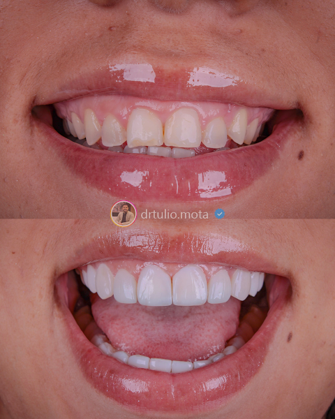 Foto 3 de Dentista Niterói l Dr Tulio Mota Clinic