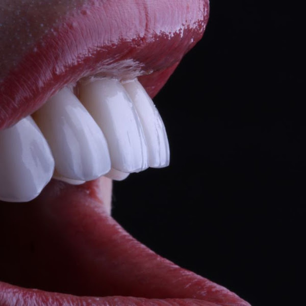 Foto 2 de Dentista no bairro Cordeiros em Itajaí, ortodontia, Restaurações, prótese, canal, implante, pediatria