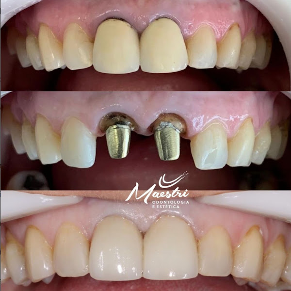 Foto 3 de Dentista no bairro Cordeiros em Itajaí, ortodontia, Restaurações, prótese, canal, implante, pediatria