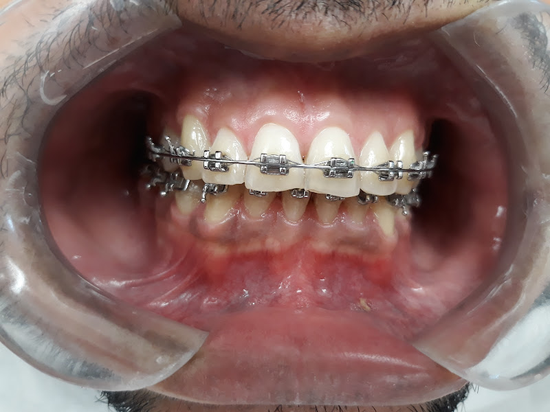 Foto de Dentista no bairro saúde Susana Yumi