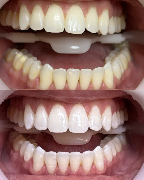 Foto 3 de Dentista no Barreiro | Dra. Raquel Bragança | Odontopediatria