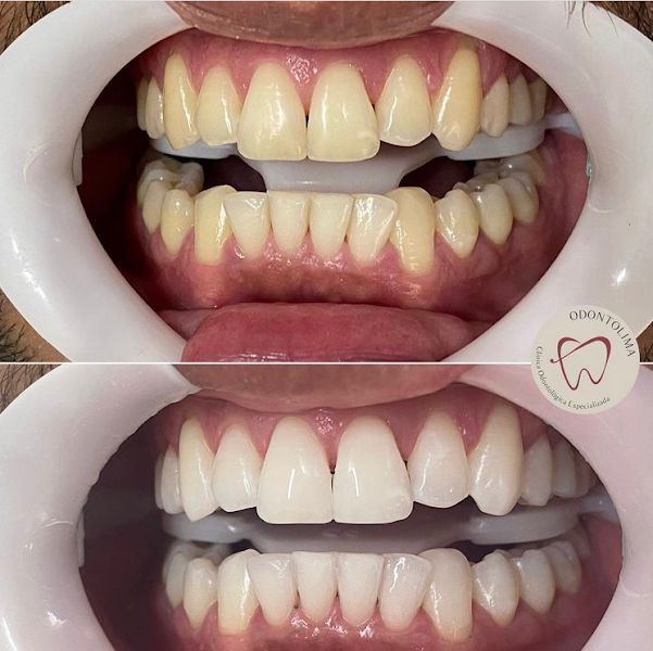 Foto 3 de Dentista no Barreiro - Odontolima - Clínica Odontológica Especializada