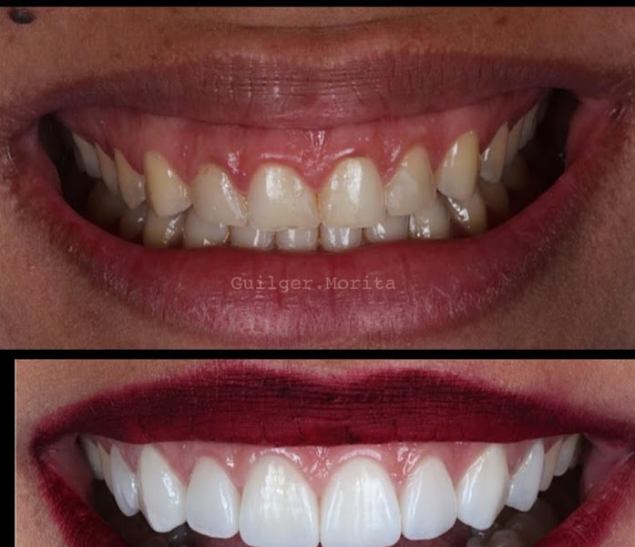 Foto 3 de DENTISTA NO CENTRO DE MAGÉ. DR. DIOGO GUIDA