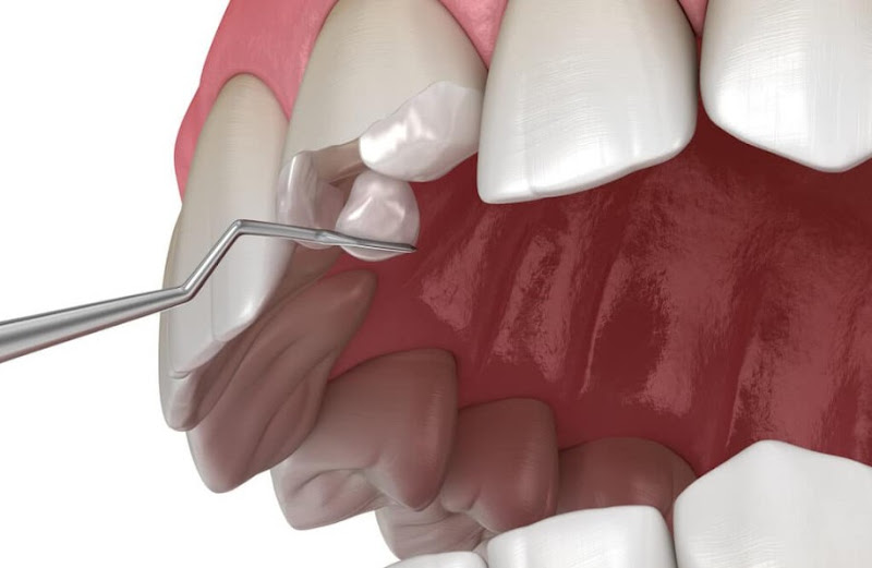 Foto 3 de Dentista no Centro de Osasco - Dra. Beatriz Mariano