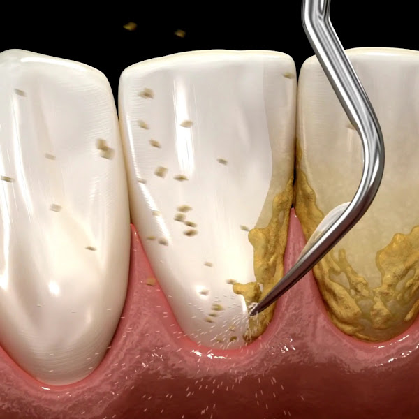 Foto 5 de Dentista no Centro de São Paulo