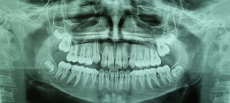 Foto 2 de Dentista no Jabaquara Dr. Alexandre Pinheiro