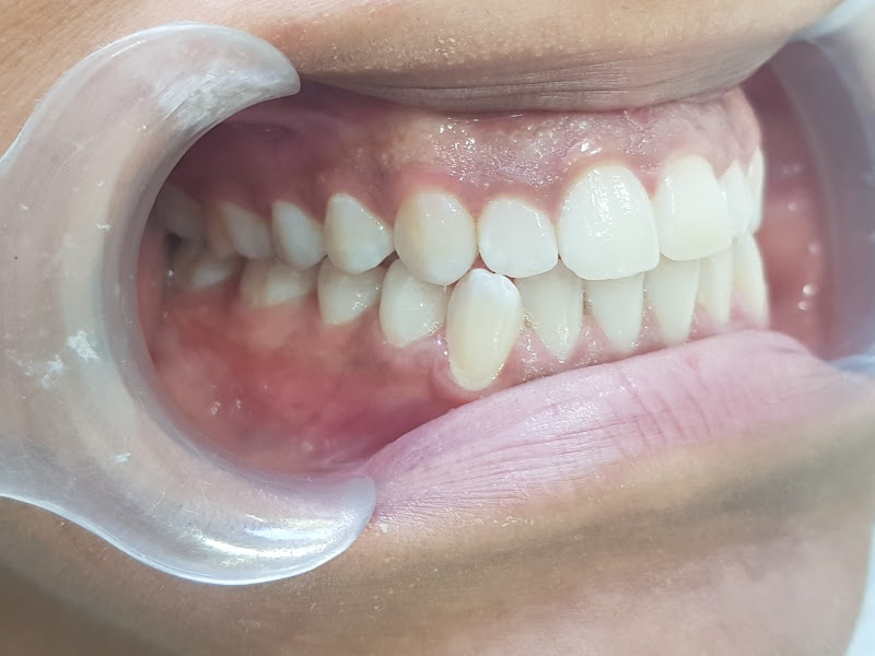 Foto 3 de Dentista no Jabaquara Dr. Alexandre Pinheiro