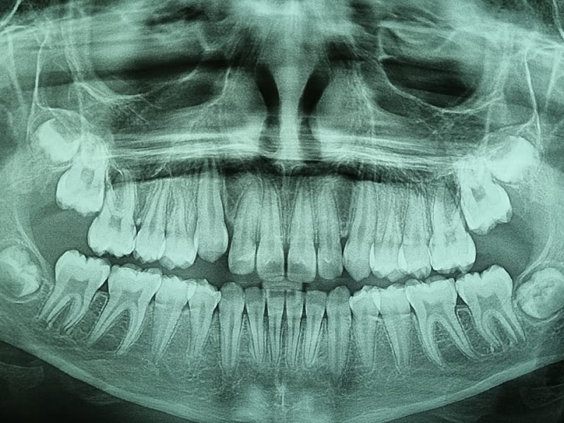 Foto 7 de Dentista no Jabaquara - Dr. Wagner Berard