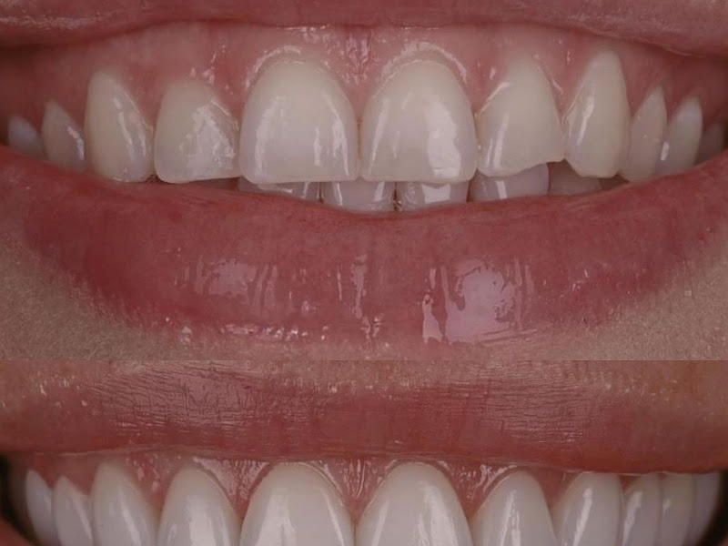 Foto 6 de Dentista no Tatuapé - Clínica Mariela Baltazar