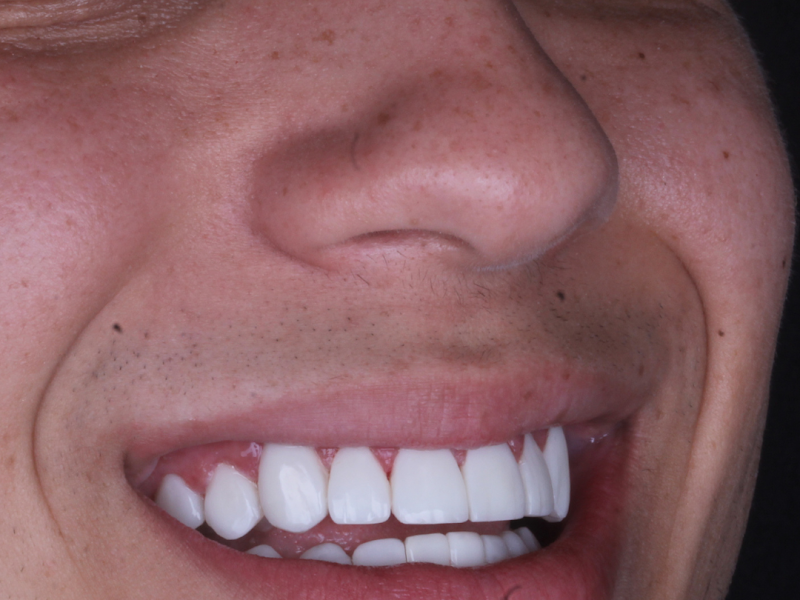 Foto 9 de Dentista no Tatuapé - Clínica Mariela Baltazar