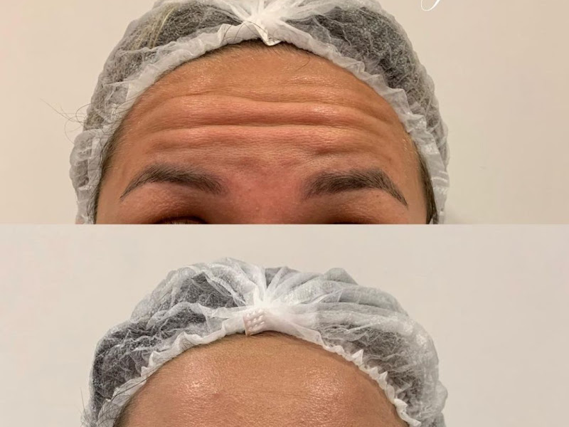 Foto 8 de Dentista no Tatuapé | Joyce Martins Odontologia