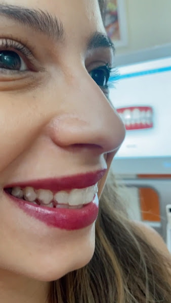 Foto 4 de Dentista Nova Iguaçu - Dra. Bianca Medeiros