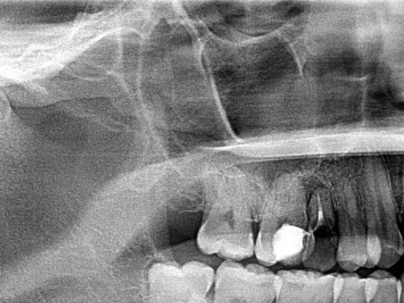 Foto 9 de Dentista | Odonto Especialle | Pacientes com autismo | Sedação