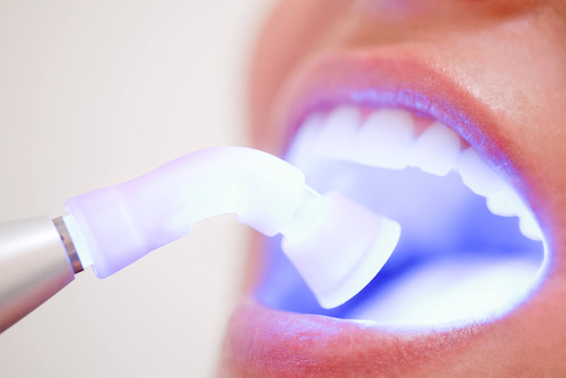 Foto 2 de Dentista Odontobiaferrodrigues