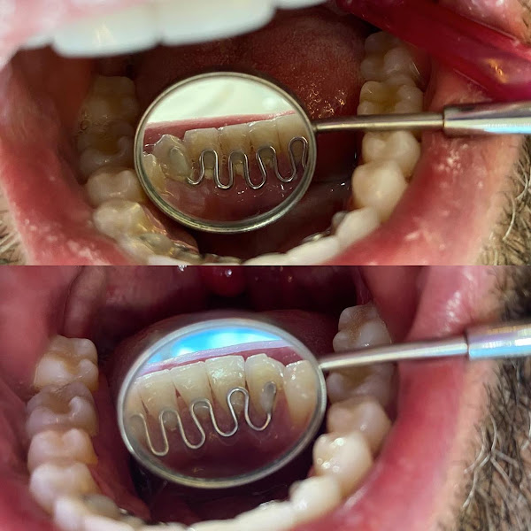 Foto 3 de Dentista - Odontologia e Estética - Dra. Mirna Laíse