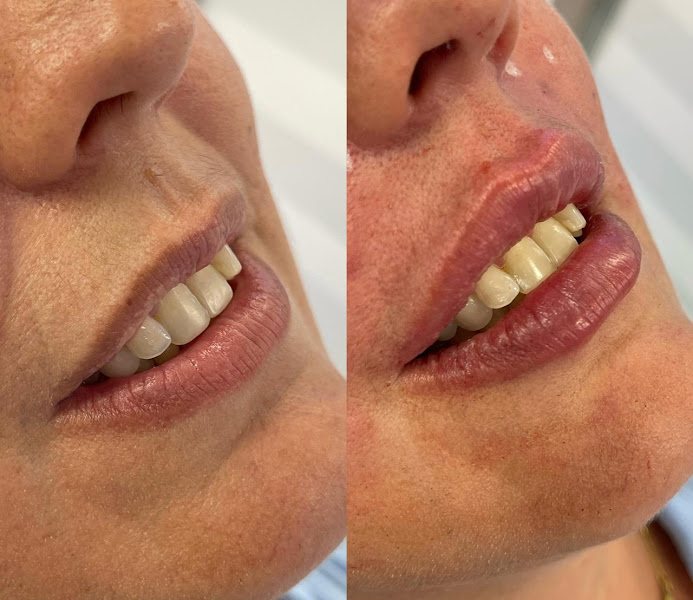 Foto 2 de Dentista Odontomix Paraíso - Odontopediatria, Tratamento de Canal, Clareamento Dental, Implante Dentário, Aparelho Invisível