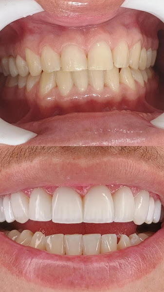 Foto 2 de Dentista perus Dr. Ricardo Pereira