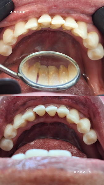 Foto 3 de Dentista Ponta Grossa Dra. Brenda de Albuquerque Santos