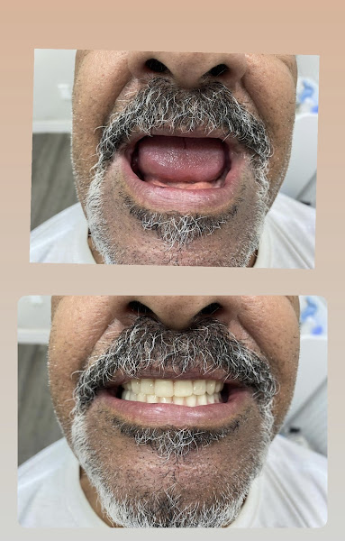Foto 3 de Dentista Popular do Brasil Unidade Retiro