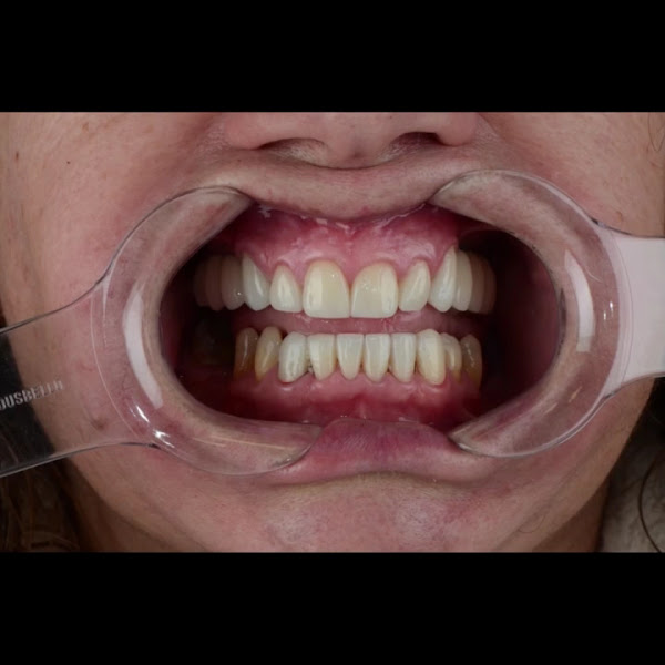 Foto 4 de Dentista Porto Alegre | Clínica Dental Center