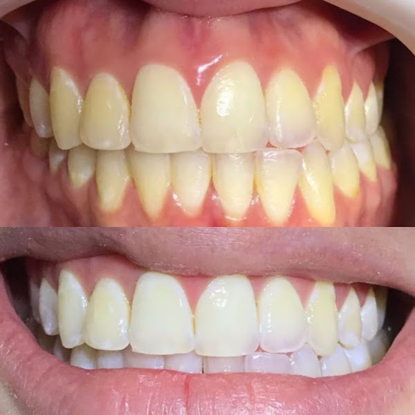 Foto 3 de Dentista Pouso Alegre - Odontologia Oliveira