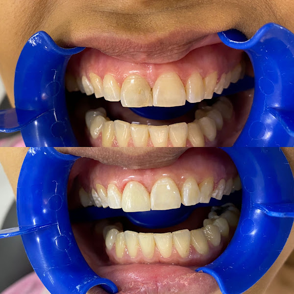 Foto 2 de Dentista Prof. Dr. Ricardo Alves - Becker e Castro Clínica Odontológica