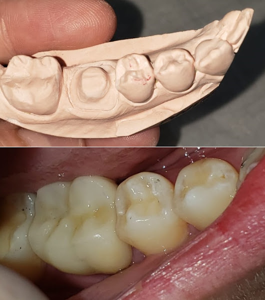 Foto 3 de Dentista Prótese | Ronco | Apneia - Uberlândia MG - Dra Merielle Rezende