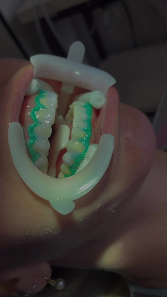 Foto 2 de Dentista Rebeca Rocha