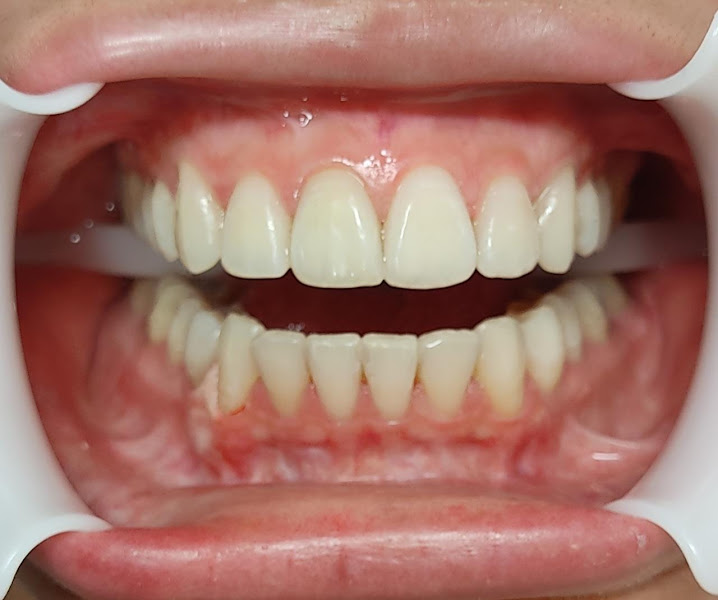 Foto 3 de Dentista Recife - Dr Marllyson Renan