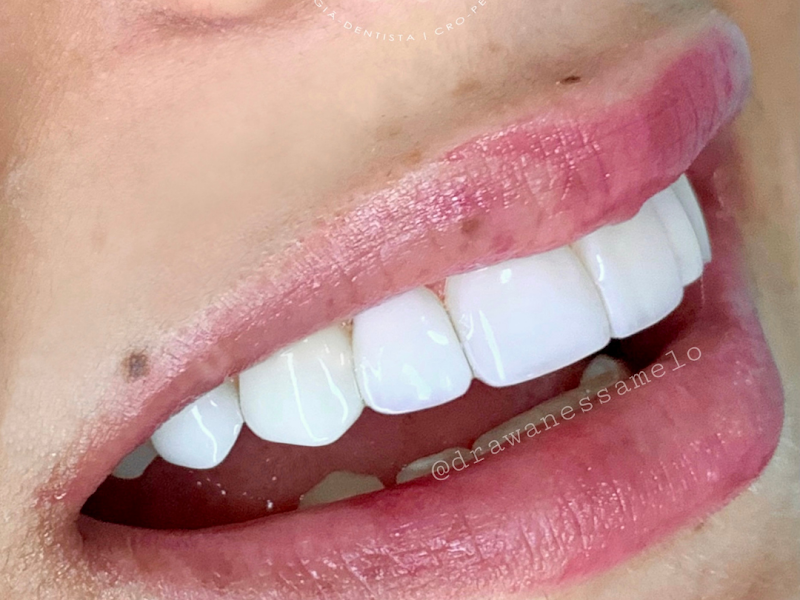 Foto 2 de dentista recife - Dra. Avany Gomes