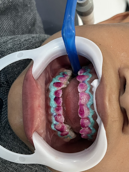 Foto 3 de Dentista Resolve