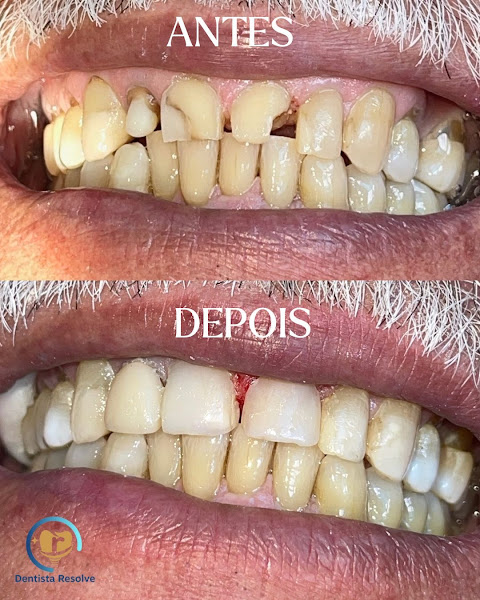 Foto 4 de Dentista Resolve
